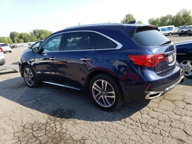 2017 Acura MDX Advance