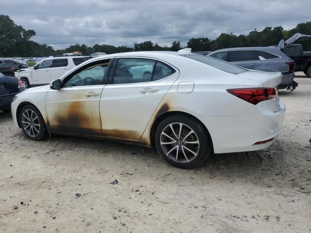 2017 Acura TLX Advance
