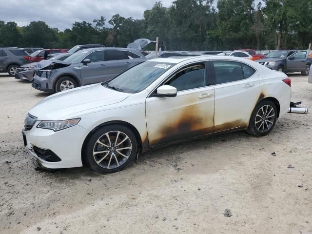 2017 Acura TLX Advance