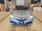 2015 Acura TLX Tech