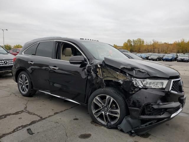 2017 Acura MDX Advance