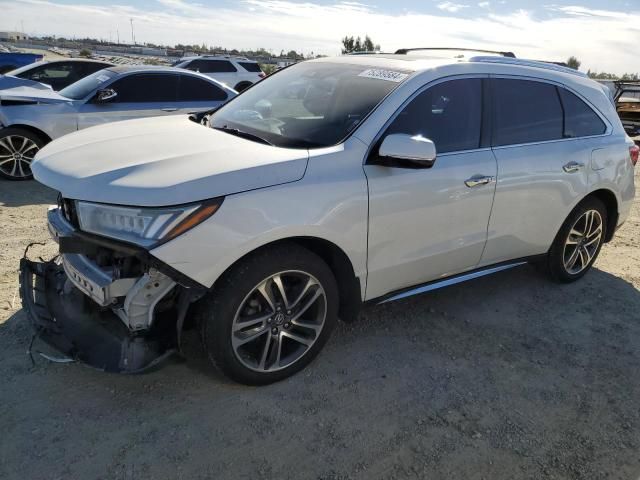 2017 Acura MDX Advance