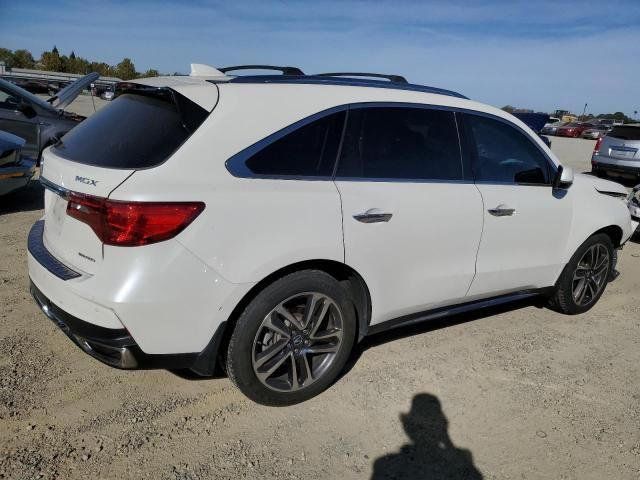 2017 Acura MDX Advance