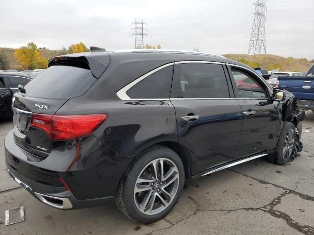 2017 Acura MDX Advance