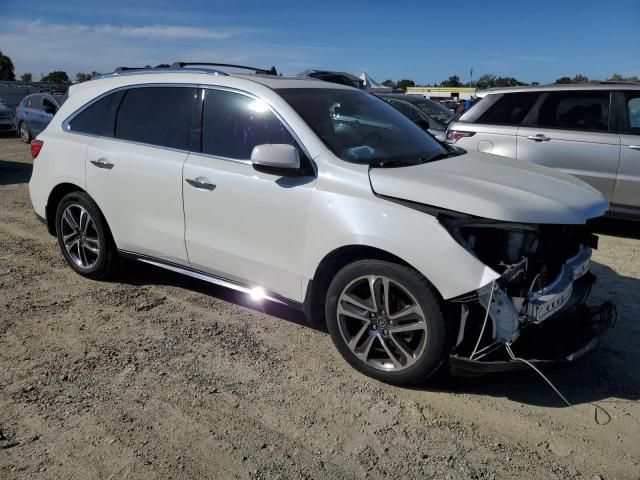 2017 Acura MDX Advance