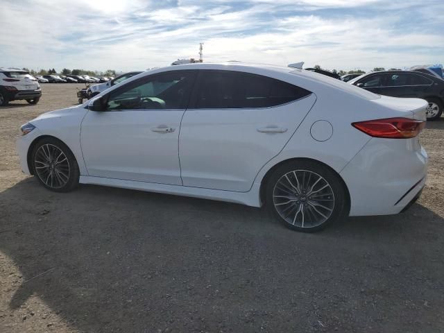 2017 Hyundai Elantra Sport