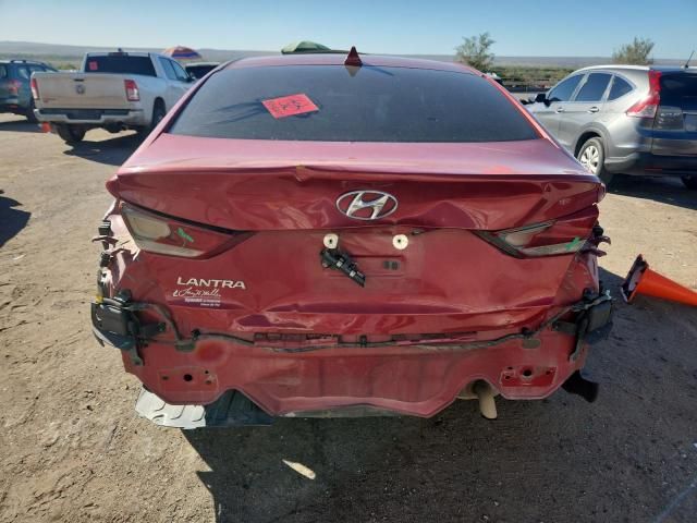 2017 Hyundai Elantra se