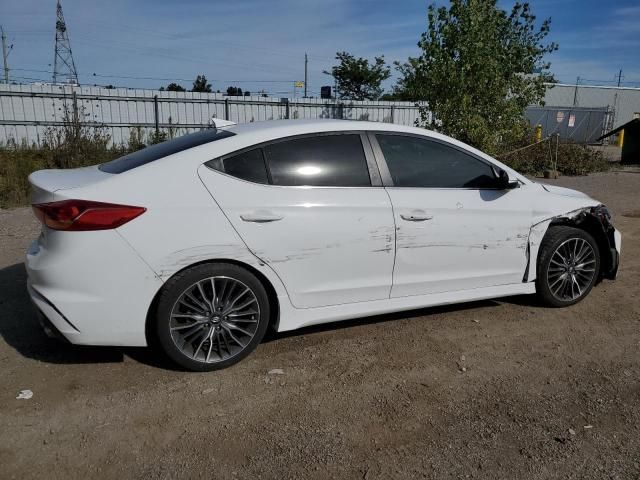 2017 Hyundai Elantra Sport
