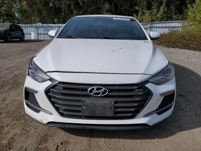 2017 Hyundai Elantra Sport