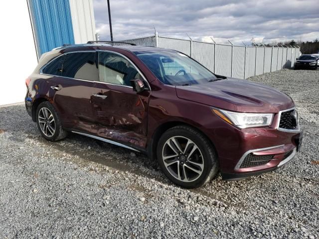 2017 Acura MDX Technology