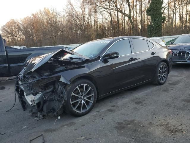 2015 Acura TLX Tech