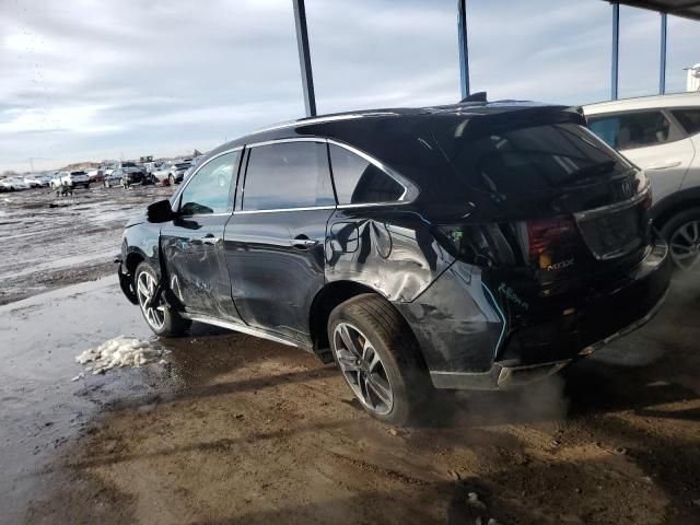 2018 Acura MDX Advance