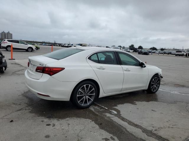 2015 Acura TLX Tech