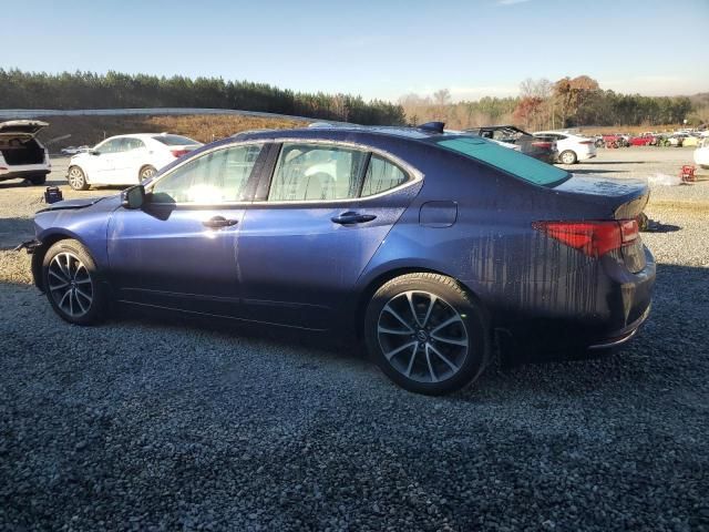 2017 Acura TLX Tech