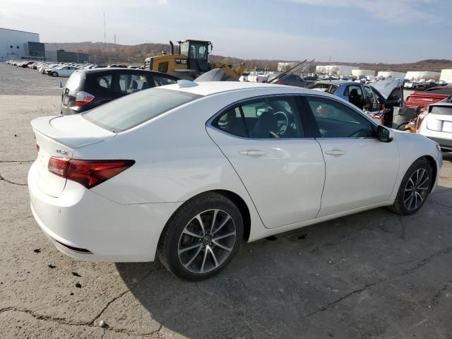 2017 Acura TLX Advance