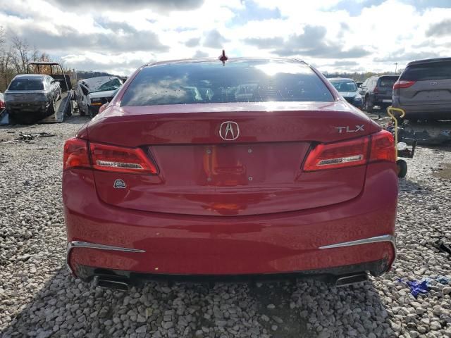 2018 Acura TLX Tech