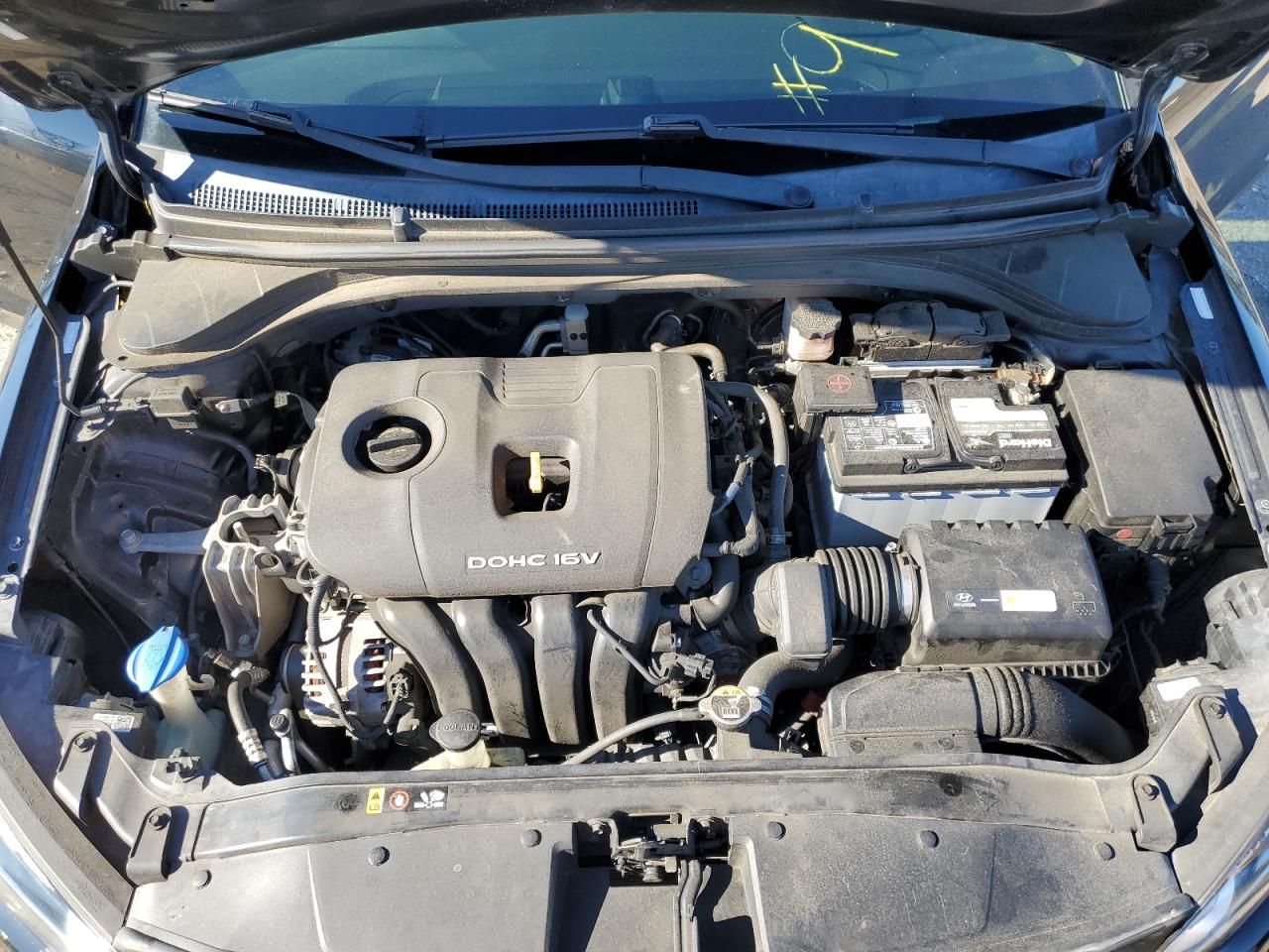 2017 Hyundai Elantra se