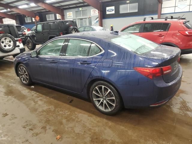 2017 Acura TLX Tech