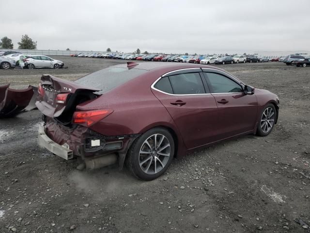 2015 Acura TLX Tech