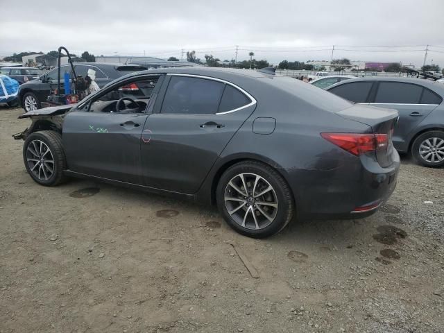 2015 Acura TLX Tech