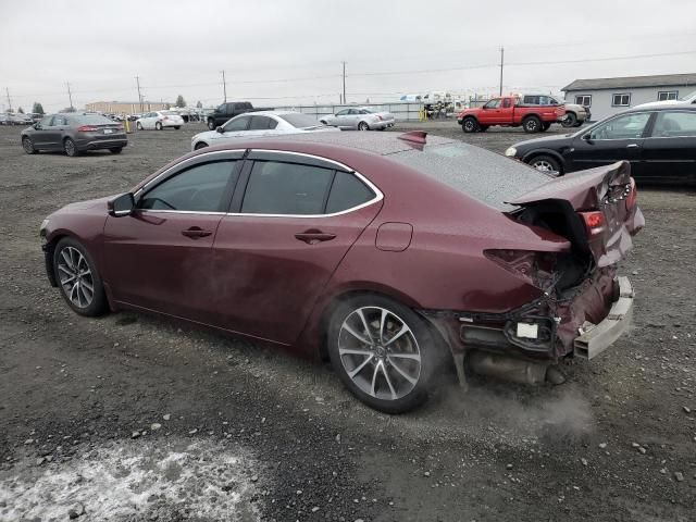 2015 Acura TLX Tech