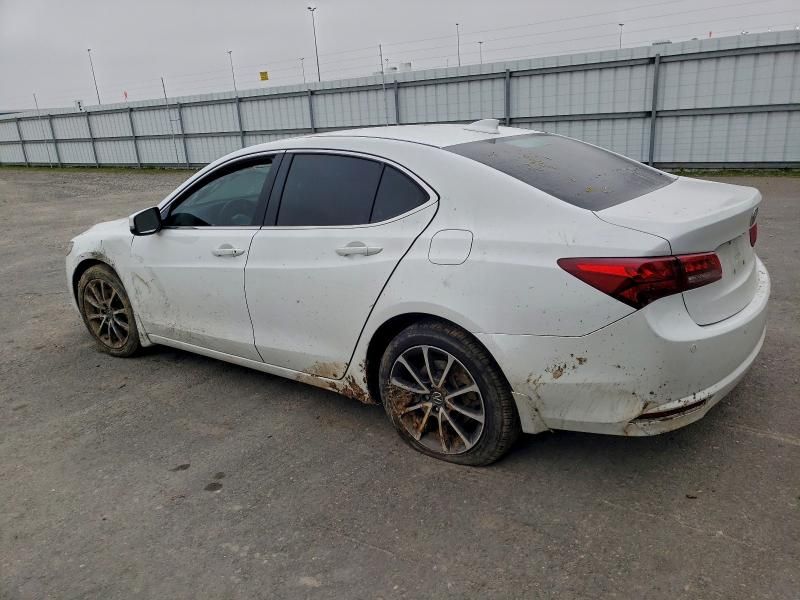 2017 Acura Tlx Advance