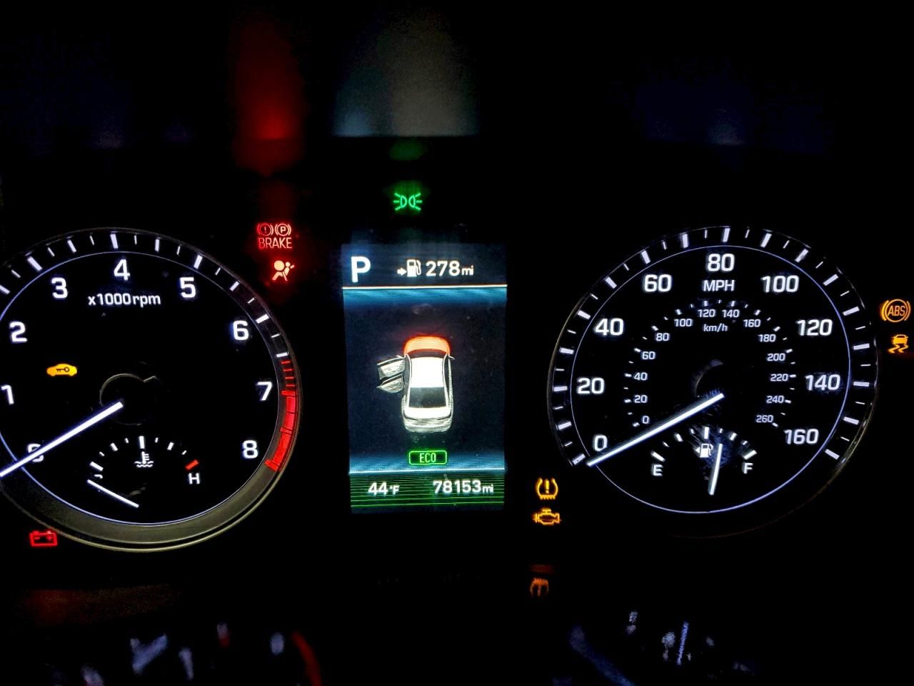 2018 Hyundai Sonata Sport