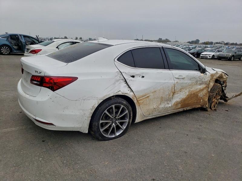 2017 Acura Tlx Advance
