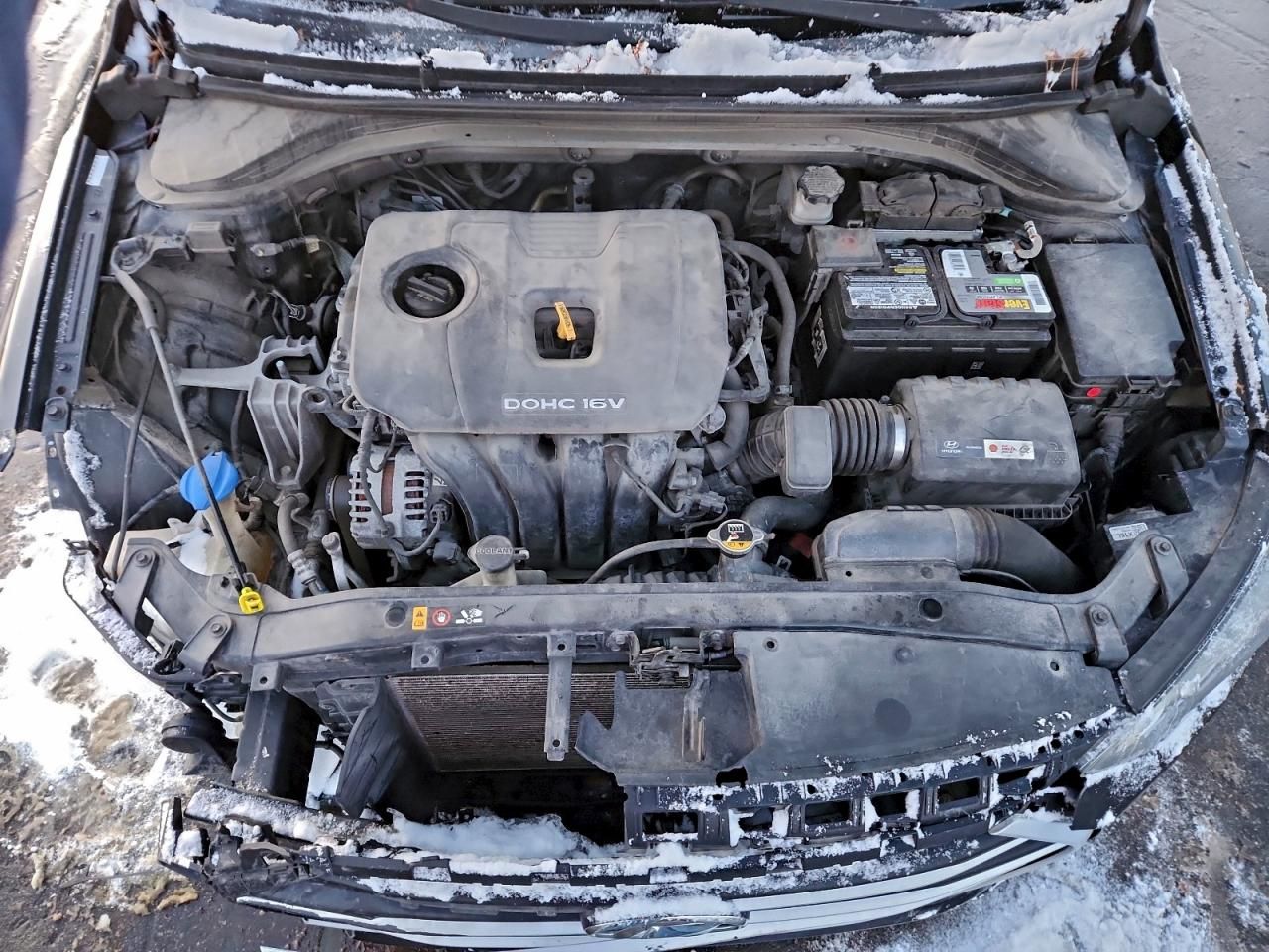 2017 Hyundai Elantra se