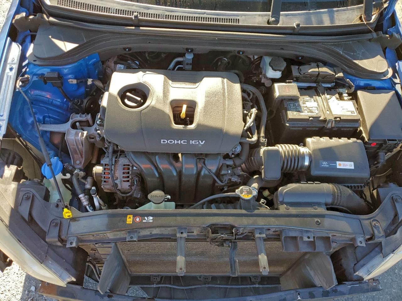 2017 Hyundai Elantra se